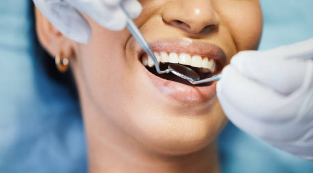 Best Broken or Chipped Tooth Repair in Bridgeville, PA