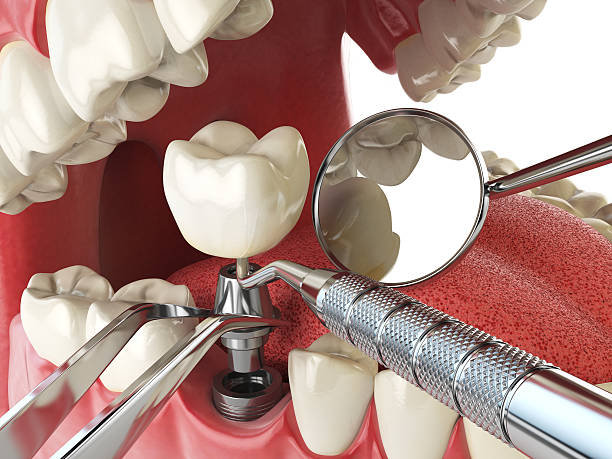 Best Emergency Treatment for Jaw Pain or Injury in Bridgeville, PA